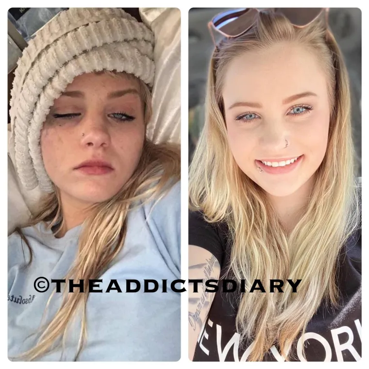 Otele su se zagrljaju smrti, pobijedile svoje demone i danas svaka od njih ponovno izgleda poput prelijepe princeze