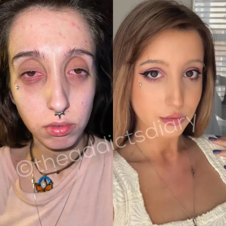 Otele su se zagrljaju smrti, pobijedile svoje demone i danas svaka od njih ponovno izgleda poput prelijepe princeze