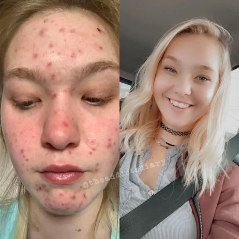 Otele su se zagrljaju smrti, pobijedile svoje demone i danas svaka od njih ponovno izgleda poput prelijepe princeze