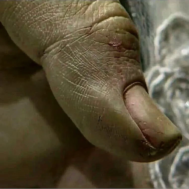 Ljude su zaprepastili detalji, nokti, koža na rukama, oči... i netko je ubrzo primijetio da neobično podsjeća na preminulu kćer spomenute gospođe.