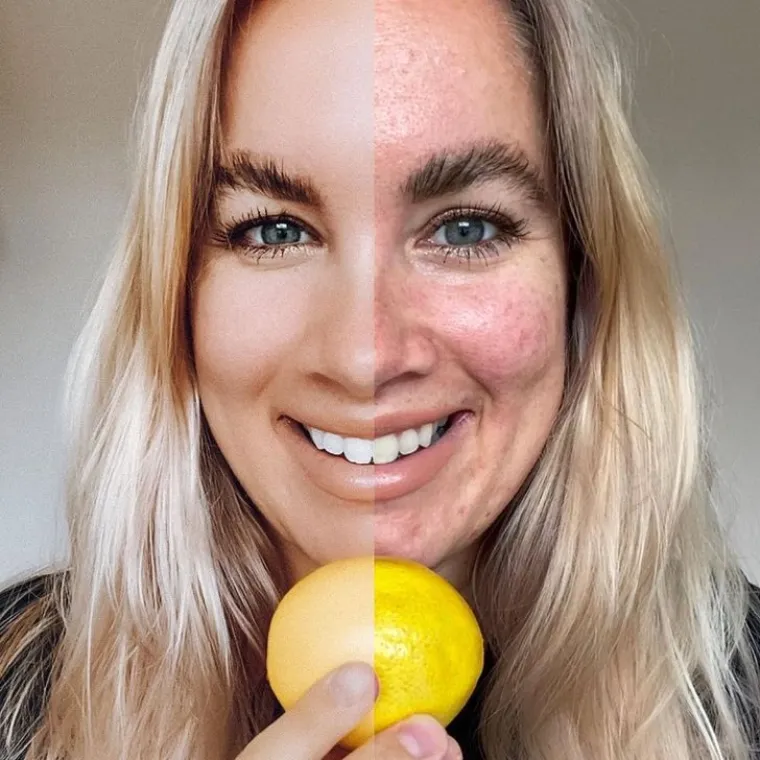 "Imate pore, a ne nedostatke! Zazmislite limun bez rupica... Njegova kora &scaron;titi voće unutra."