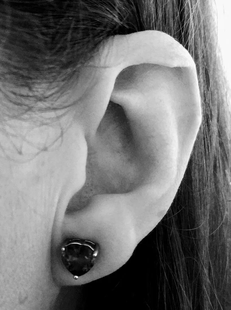 
13.Darwinova kvržica: 

Obično javlja kao zadebljanje u&scaron;ne &scaron;koljke na sredini njenog gornjeg zavoja, a odgovara vrhu uha kod drugih sisavaca.  Javlja se kod približno 10.4% populacije, tko ju je otkrio se vidi se iz imena,  a prema njemu, ona je vestigalno obilježje koje dokazuje da svi primati imaju zajedničkog pretka. 