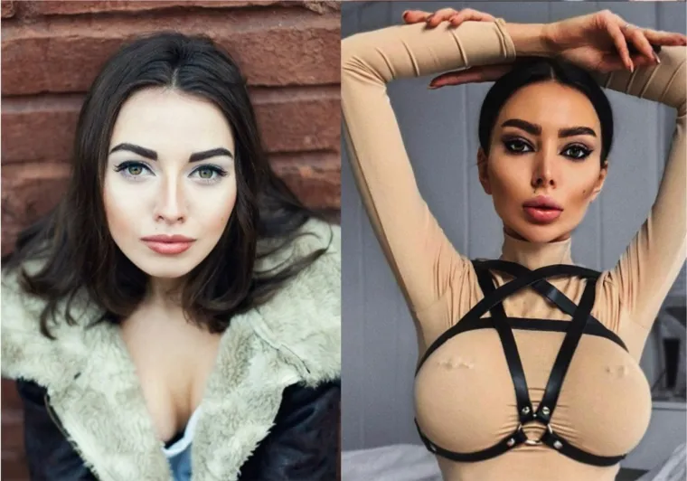 Alena Omovič inače je poznata i pod nadimkom &quot;ukrajinska Kim Kardashian&quot;, prati je 1,6 milijuna ljudi, a minulih je godina doista uvelike promijenila fizički izgled.