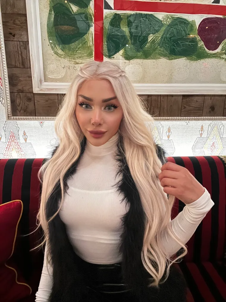 Candice nije jedina koja se odvažila maknuti filere, mnoge druge poznate osobe i influenceri odlučili su zamijeniti svoj umjetni izgled s prirodnim te su masovno počeli vaditi filere iz tijela. Između ostalih, Khloe Kardashian je također priznala da nije zadovoljna svojim izgledom s filerima. 
