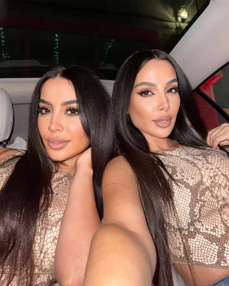 Vidite dvostruko? Izvolite uputnicu, hitno odite pregledati galeriju s najljep&scaron;im blizankama svijeta