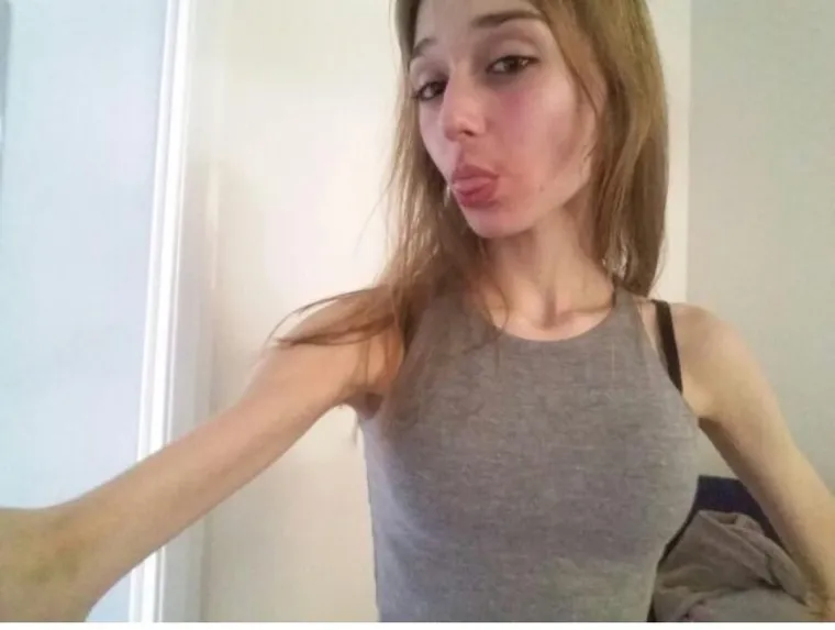 Patila je od bulimije i depresije, a sad je jedna od najljepših bodybuilderica