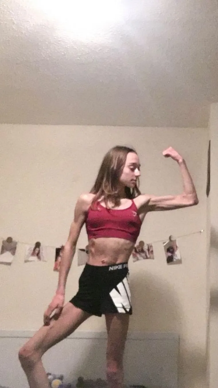 Patila je od bulimije i depresije, a sad je jedna od najljepših bodybuilderica