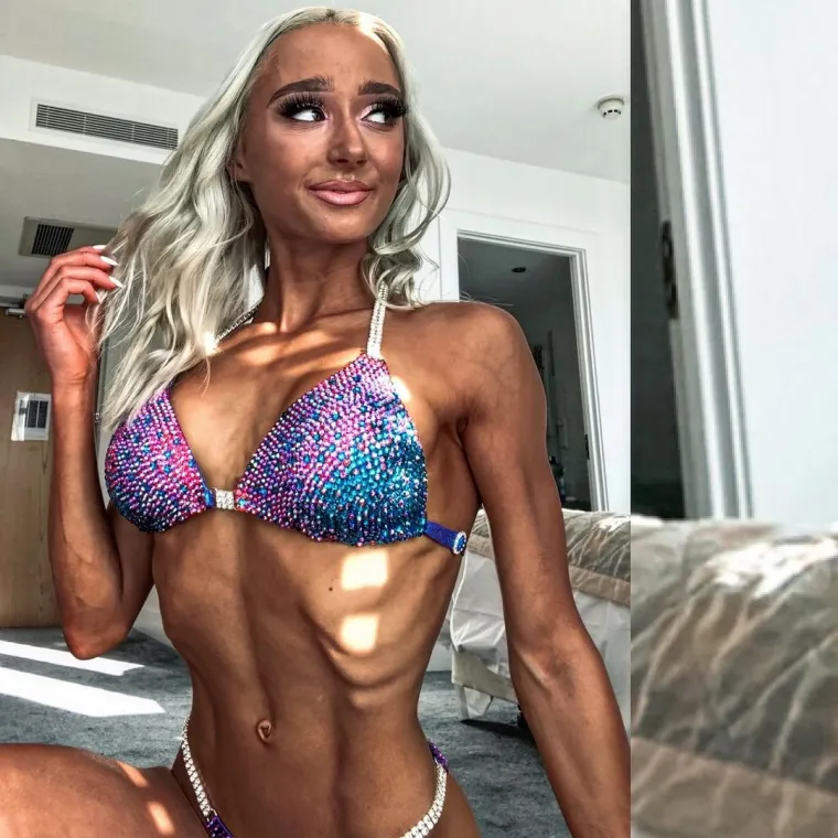 Patila je od bulimije i depresije, a sad je jedna od najljepših bodybuilderica