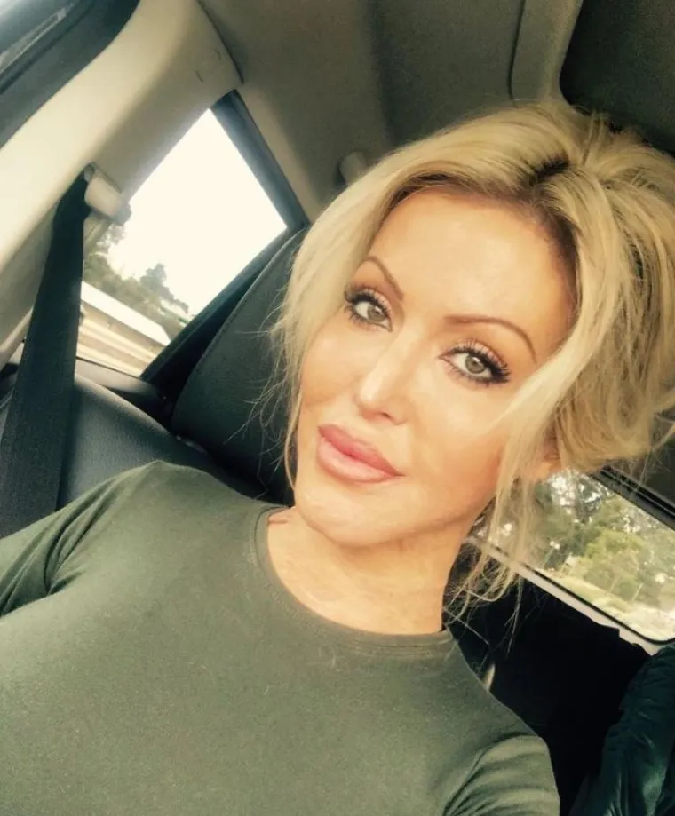 Dana je zaključila: "Ponosna sam na svoje ožiljke i naučila sam ih voljeti. U uređenom svijetu, biram da me ne uređuju."

Dana kaže da je snimka potpuno neobrađena i kaže da čak nije koristila lažnu preplanulost, lažne nokte ili specijalne efekte i rasvjetu kako bi izgledala tako dobro.
