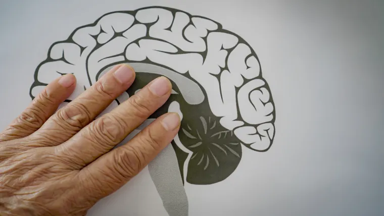 Najčešće se pojavljuje kod osoba starijih od 60 godina, a kod oko 6 od 100 ljudi iznad 65 godina će se ona razviti. Može se pojaviti i kod mlađih osoba premda je to stanje prije 60-ih godina jako rijetko. Rana pojava bolesti može početi kada su ljudi u svojim tridesetima, 40-im ili 50-ima.