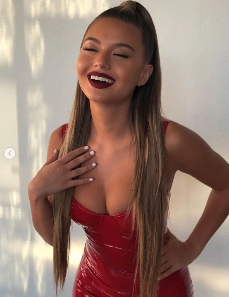 Svi bi ju mazili i pazili, a on će na sud: Prekrasna manekenka tužila popularnog ko&scaron;arka&scaron;a zbog nasilja