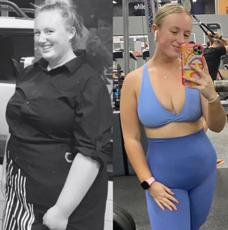 Napravila si je profil na Instagramu, koji koristi kao stranicu za mršavljenje, ali je shvatila da je čak i nakon što je izgubila 2 kg i dalje nesretna. U razgovoru za Daily Star, influencerica s 17.500 pratitelja je rekla: “Nekoć sam imala 107 kg i mrzila sam svoje tijelo, tako da je ova stranica započela kao stranica za mršavljenje.&quot;
