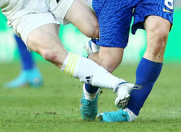 Mateo Kovačić se ozlijedio nakon prekršaja 'za zatvor', grozne fotografije iz Engleske obilaze svijet