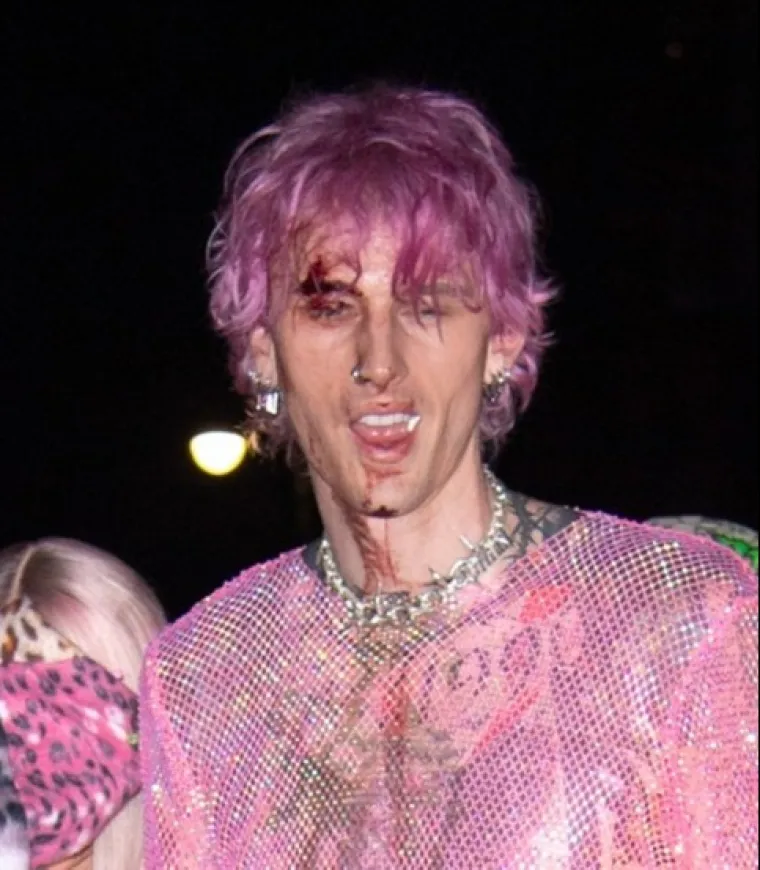 Megan Fox se opet mora kriti od sramote: Machine Gun Kelly krvav napustio famozni after party u Madison Square Gardenu