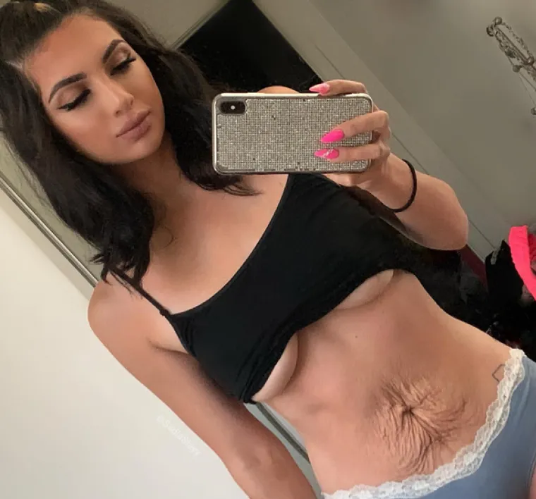 Beauty influencerica Sadia Slayy na društvenim je mrežama pokazala kako joj trbuh izgleda 9 mjeseci nakon rođenja sina. &quot;Možda mislite da je ovo odvratno i pitate se zašto to objavljujem. To je u redu. No puno vas vidjet će ovo i osjetiti olakšanje&quot;, poručila je između ostalog.