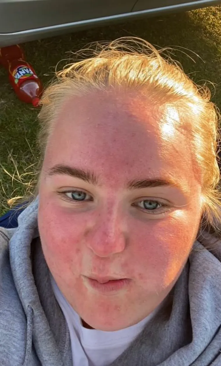 "Trebala sam staviti kremu za sunčanje, iako je bilo 20 stupnjeva, ali to nije bilo jučer, bilo je pro&scaron;li tjedan. Ne bih i&scaron;la po ovakvom vremenu na sunce", dodala je Eva.