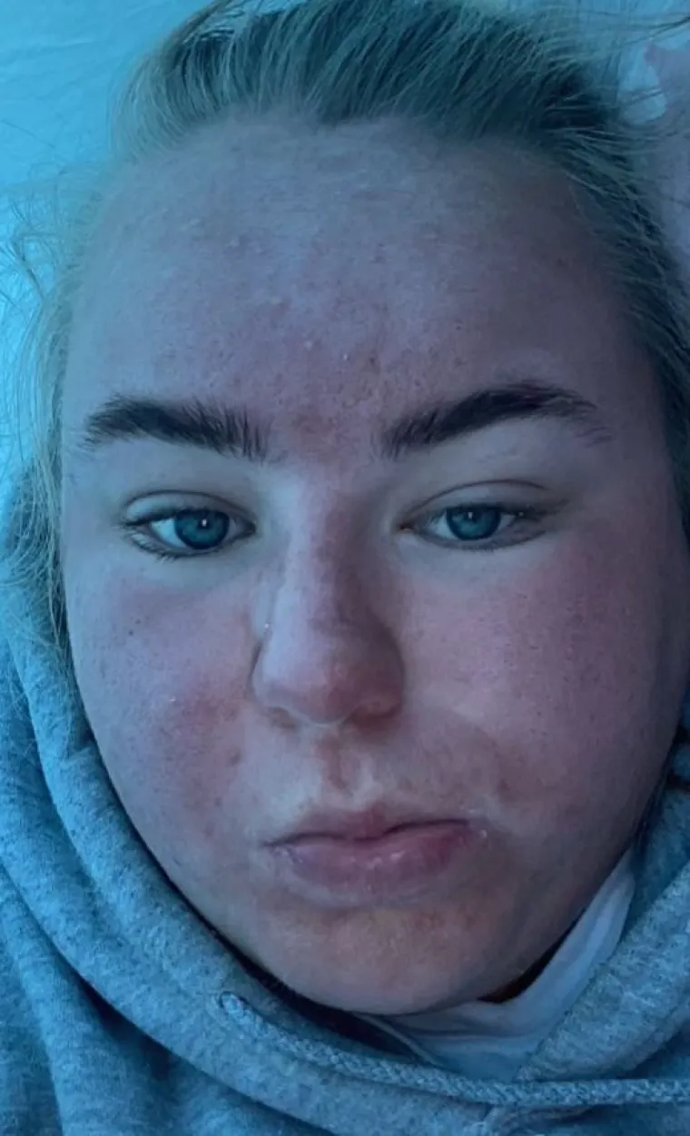 "Tvoje lice na jednoj od fotografija je bilo toliko crveno da je moju sobu obasjalo crvenim sjajem", napisala je jedna osoba, a druga je dodala: "Sljedeći put morate koristiti UV za&scaron;titu."