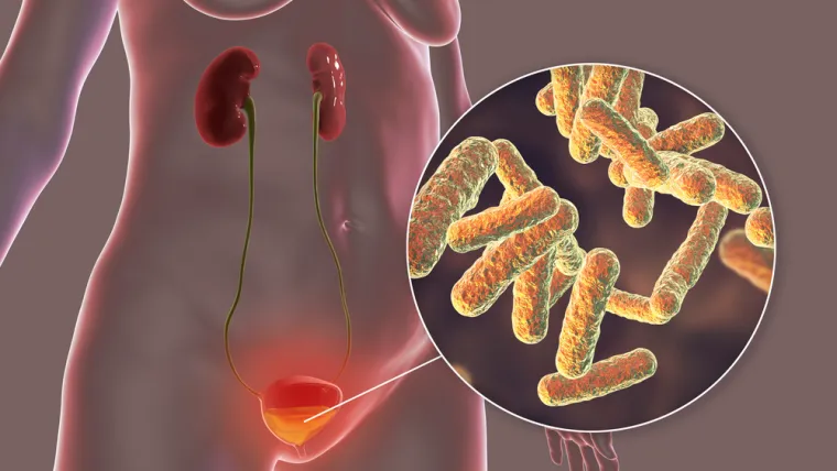 Liječenje antibioticima: Liječenje obično nije potrebno kod starijih osoba i infekcija bez simptoma. Prvi postupak je pijenje obilja tekućine, što često dovodi do izlječenja blage infekcije mokraćnog mjehura. Ispiranje mokraće izbacuje mnoge bakterije iz tijela; tjelesne prirodne obrambene snage odstranjuju preostale uzročnike infekcije. Prije propisivanja antibiotika, liječnik utvrđuje ima li osoba kakvo stanje koje bi još više moglo pogoršati infekciju mokraćnog mjehura, kao što je poremećaj građe ili živčane opskrbe, šećerna bolest ili oslabljen imunosni sustav koji smanjuje sposobnost osobe da se bori s infekcijom. Takva stanja mogu se agresivnije liječiti, osobito stoga, što će se infekcija vjerojatno vratiti čim osoba prestane uzimati antibiotike. Uzimanje antibiotika na usta tijekom tri dana ili čak pojedinačna doza obično su učinkoviti ako infekcija nije dovela do nikakvih komplikacija. U slučaju tvrdokornije infekcije, antibiotici se obično uzimaju sedam do 10 dana.