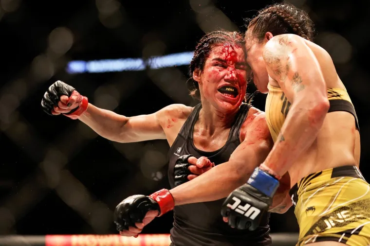 UFC borkinja završila kod plastičnog kirurga nakon užasne ozljede: 'Ostala je bez velikog dijela glave'