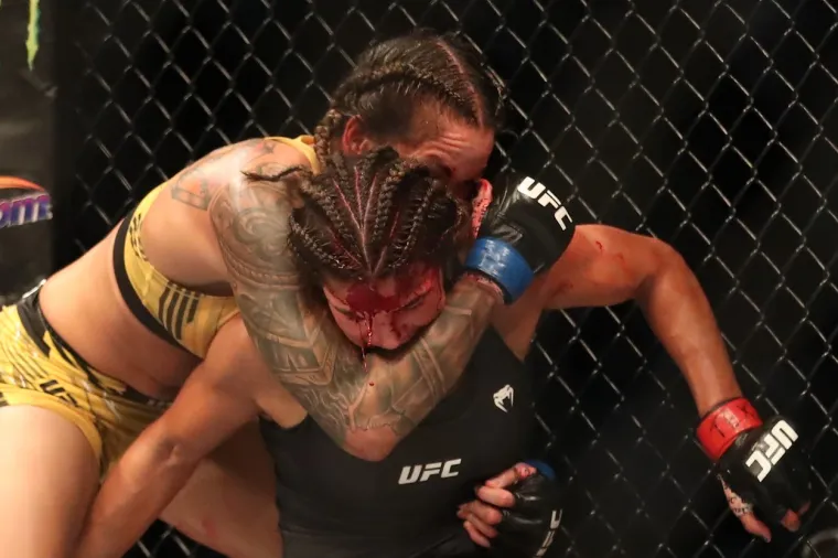 Zvijezda UFC-a te&scaron;ko stradala u borbi za titulu: 'Ostala je bez komada čela, morat će na kirurgiju'