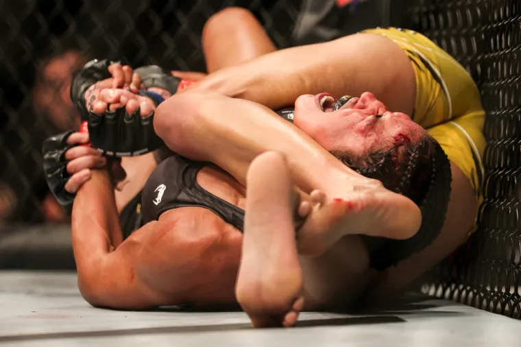 Zvijezda UFC-a te&scaron;ko stradala u borbi za titulu: 'Ostala je bez komada čela, morat će na kirurgiju'