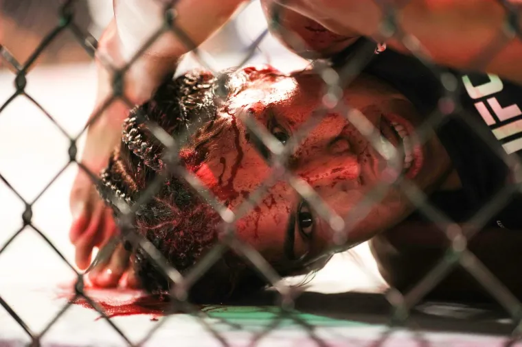 Zvijezda UFC-a te&scaron;ko stradala u borbi za titulu: 'Ostala je bez komada čela, morat će na kirurgiju'