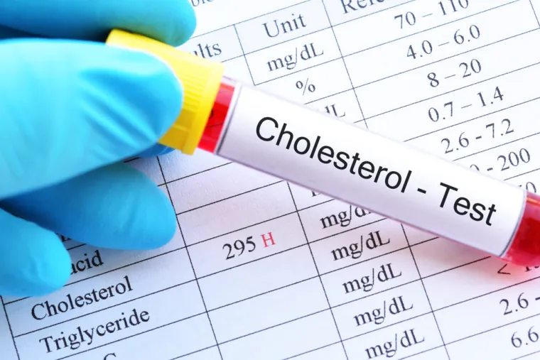 Preporučene  vrijednosti kolesterola: Ukupni kolesterol &lt;5,0 mmol/l; LDL kolesterol &lt; 3,0 mmol/l; HDL kolesterol &gt;1,0 mmol/l za muškarce te za žene &gt;1,2mmol/l