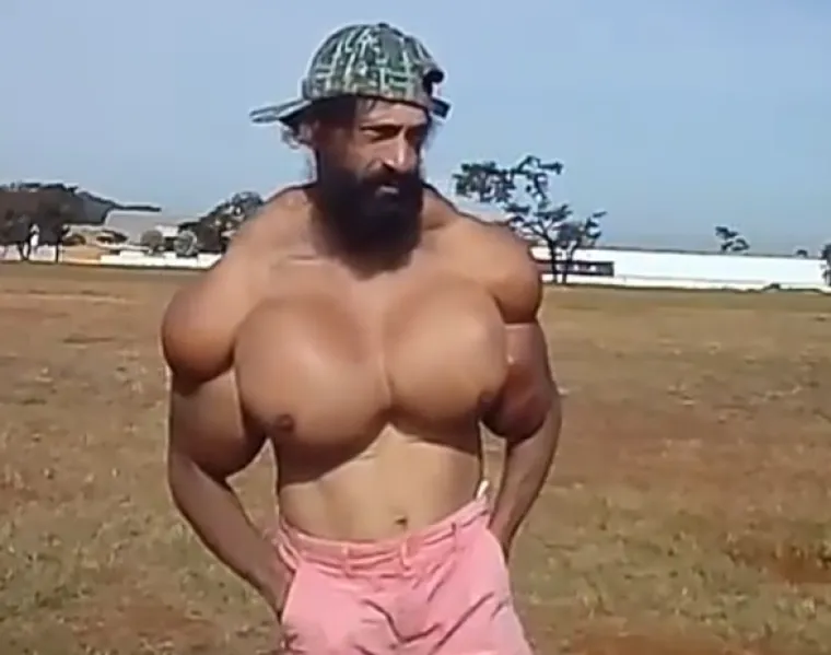 'Brazilski Hulk' iznenada umro na rođendan nakon &scaron;to je ubrizgao sintol u mi&scaron;iće: Bio je totalno deformiran, prozvali ga čudovi&scaron;tem