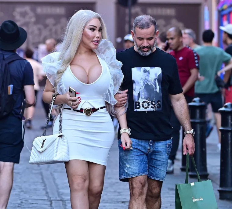Jessica Alves se potpuno promijenila: Nekad je bila 'ljudski Ken', sada je 'ljudska Barbie' s XXL grudima
