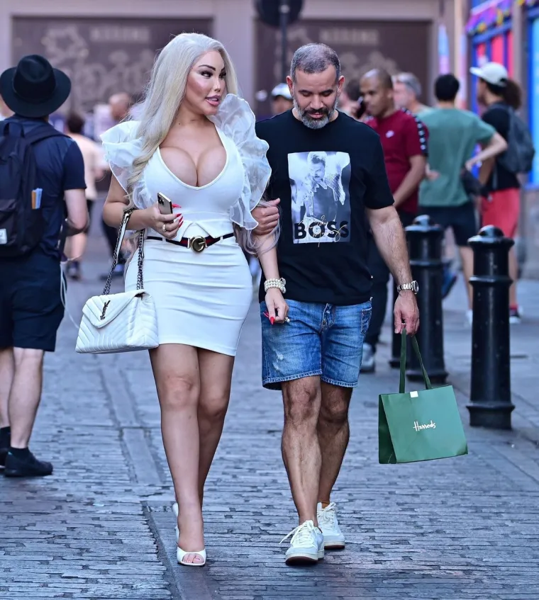 Jessica Alves se potpuno promijenila: Nekad je bila 'ljudski Ken', sada je 'ljudska Barbie' s XXL grudima