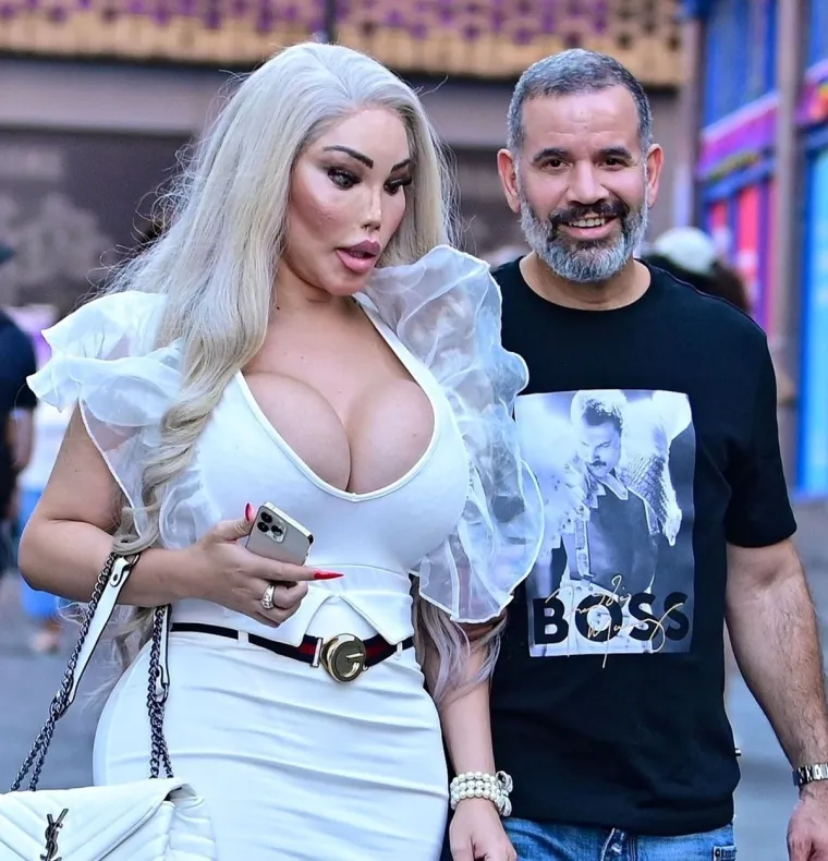 Jessica Alves se potpuno promijenila: Nekad je bila 'ljudski Ken', sada je 'ljudska Barbie' s XXL grudima