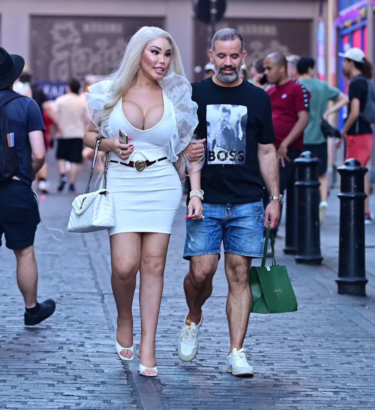 Jessica Alves se potpuno promijenila: Nekad je bila 'ljudski Ken', sada je 'ljudska Barbie' s XXL grudima