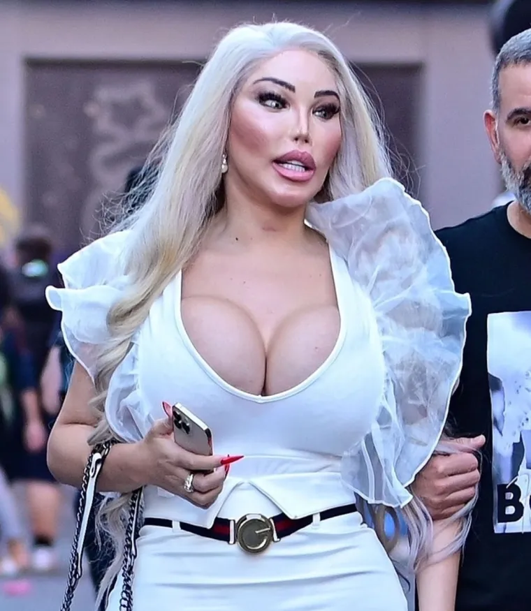 Jessica Alves se potpuno promijenila: Nekad je bila 'ljudski Ken', sada je 'ljudska Barbie' s XXL grudima