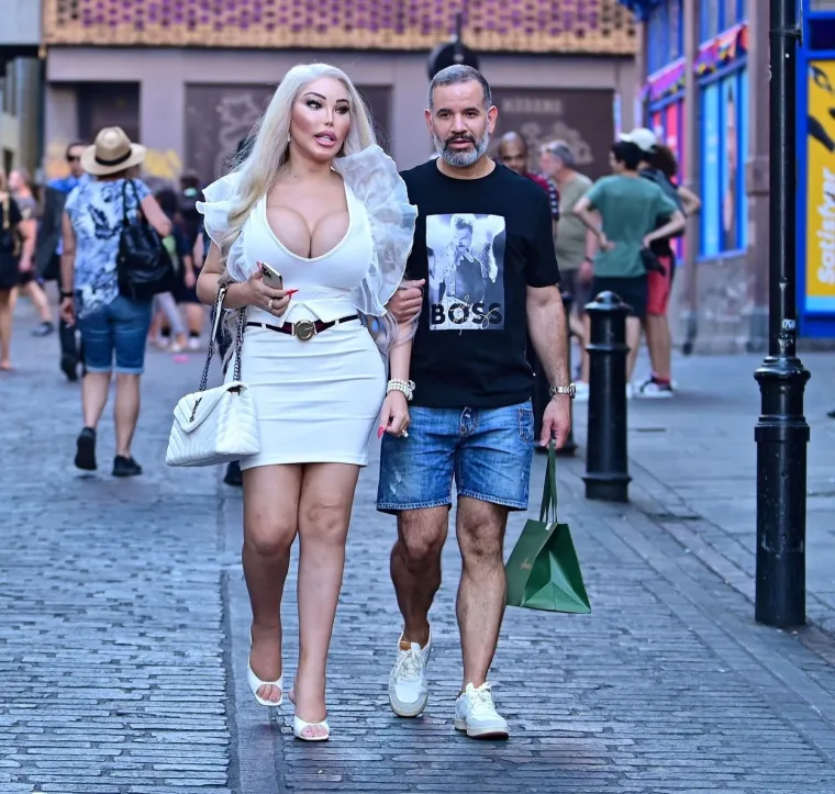 Jessica Alves se potpuno promijenila: Nekad je bila 'ljudski Ken', sada je 'ljudska Barbie' s XXL grudima