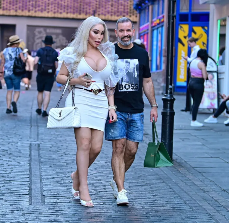 Jessica Alves se potpuno promijenila: Nekad je bila 'ljudski Ken', sada je 'ljudska Barbie' s XXL grudima