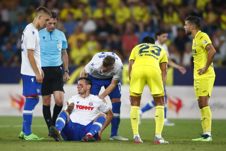 'Splitski Rocky' Nikola Kalinić zavr&scaron;io razbijen i obliven krvlju, ali iznudio je time penal i donio Hajduku nadu