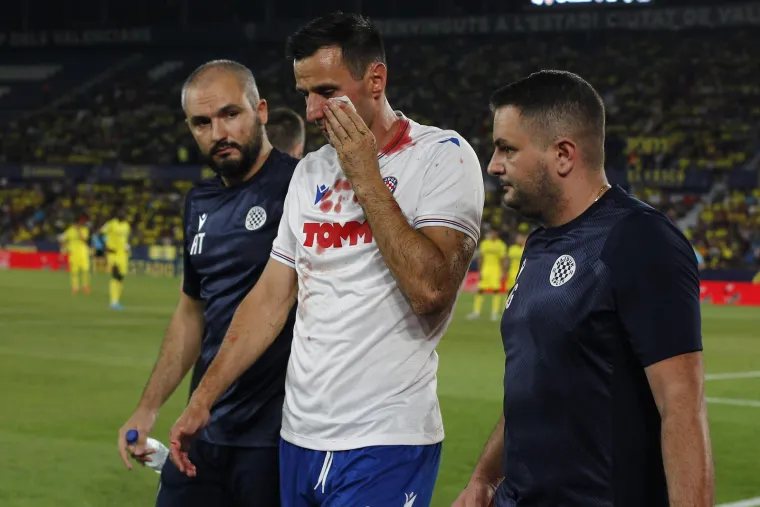 'Splitski Rocky' Nikola Kalinić zavr&scaron;io razbijen i obliven krvlju, ali iznudio je time penal i donio Hajduku nadu