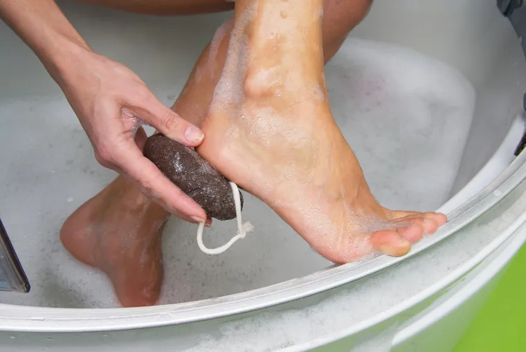 Koristite aloju preko noći! Pri tome možete koristiti ili list aloe ili čisti gel aloe. Nanesite mesnati dio biljke ili gel na žulj i prekrijte zavojem. Žulj bi sada trebao biti dovoljno mekan da se ukloni.