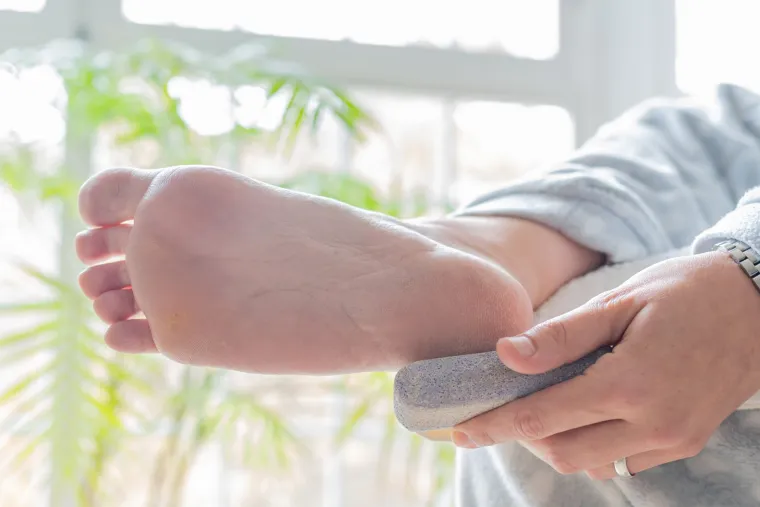 Iskoristite ulje iz vitamina A i E! Vitamini mogu pomoći u liječenju vaše kože, čak i kada se koriste lokalno. Uzmite sterilnu iglu i zabodite u kapsulu vitamina A ili E. Skupite ulje i nanesite ga na žulj. Učinite to prije spavanja i nastavite dok žulj ne zacijeli.