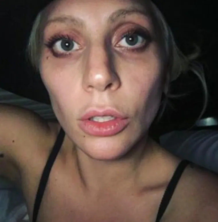 Lady Gaga često na Instagramu objavi selfie na kojem se ponosi svojom blistavom kožom, a fanove redovito obavještava o svojoj rutini njege kože...