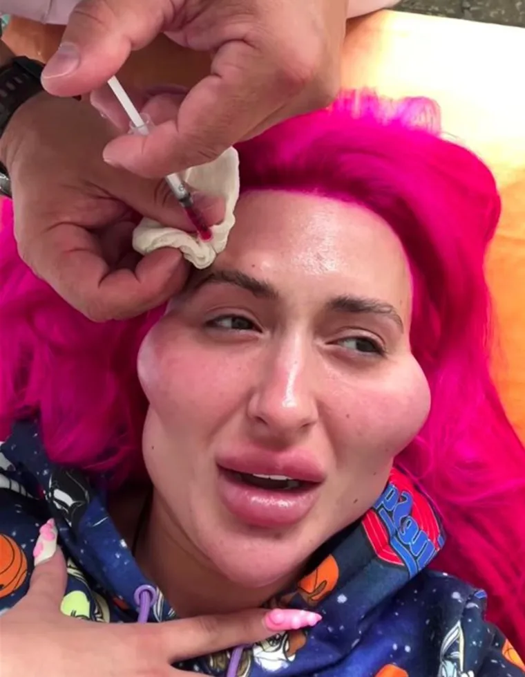 Žena s 'najvećim obrazima na svijetu' pokazala potpuno novi ekstrem: 'Ako me danas vidite u gradu s rogovima...'