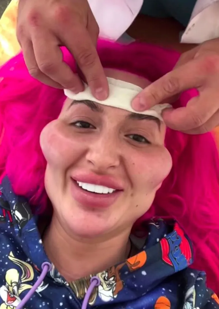 Žena s 'najvećim obrazima na svijetu' pokazala potpuno novi ekstrem: 'Ako me danas vidite u gradu s rogovima...'