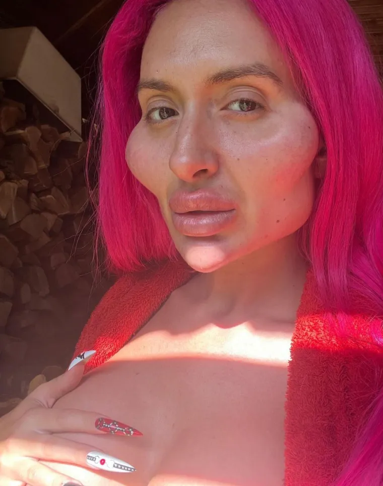 Žena s 'najvećim obrazima na svijetu' pokazala potpuno novi ekstrem: 'Ako me danas vidite u gradu s rogovima...'