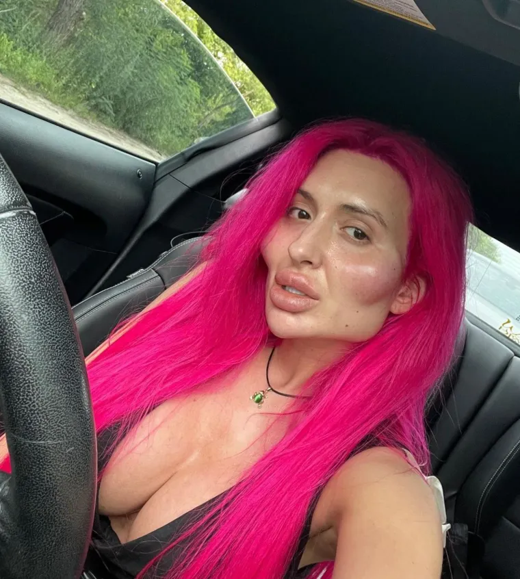 Žena s 'najvećim obrazima na svijetu' pokazala potpuno novi ekstrem: 'Ako me danas vidite u gradu s rogovima...'