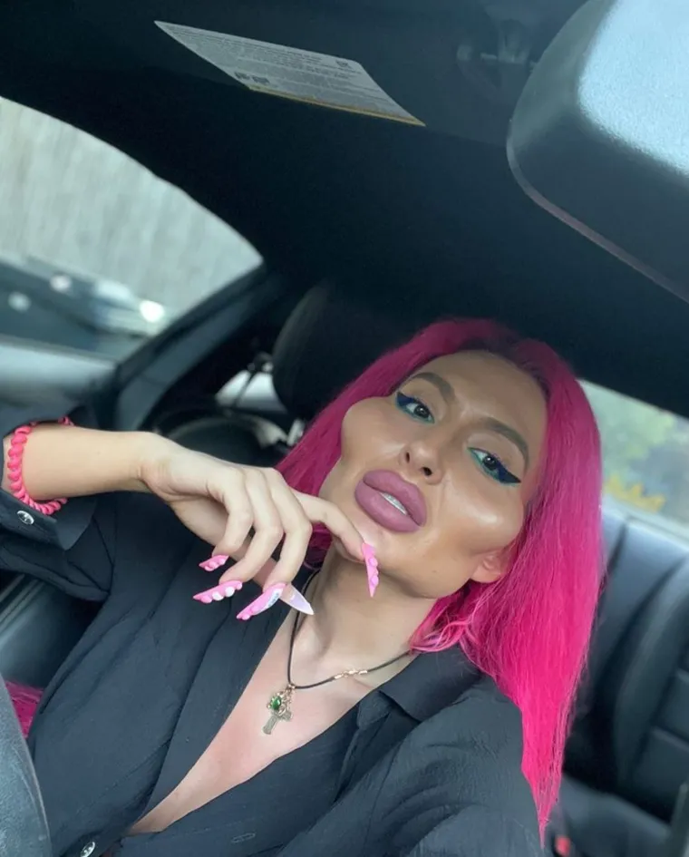 Unatoč kritikama, Anastasia ostaje zadovoljna svojim izgledom i planira nastaviti s estetskim zahvatima. U intervjuu za "The Sun" izjavila je: "Možda mislite da su moje jagodice prevelike, ali ja mislim da su premale. Moram ih uskoro ponovno osvježiti."
