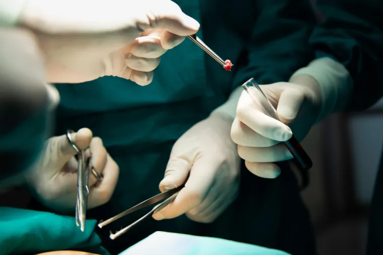 Kada je rak u najranijoj fazi i još nije vidljiv, može se otkriti samo na osnovi rezultata histologije i biopsije. Ove pretrage liječnici propisuju ako tijekom pregleda posumnjaju da nešto nije u redu s grlićem materice. U ovoj fazi, neoplazma (tumor) najčešće nema nikakve prateće simptome.