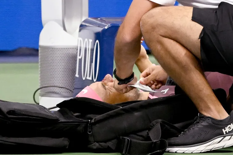 Rafael Nadal se ozlijedio u pobjedi na US Openu, reket ga pogodio u nos: 'To mi se dogodilo i s palicom za golf...'