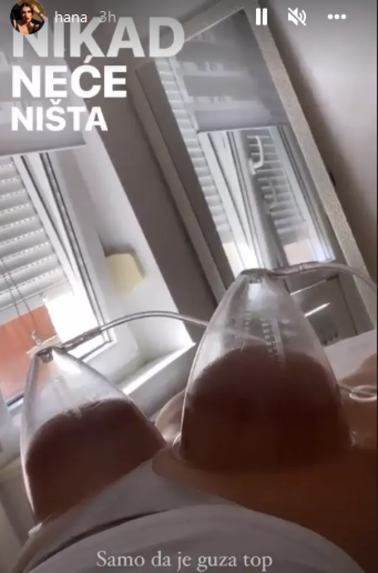 Hana Hadžiavdagić šokirala objavom: Iz prve ruke pokazala kako izgleda pomalo bizaran tretman brazilskog 'podizanja guze'