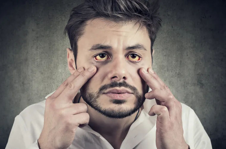 Malokrvne osobe često osjećaju umor, malaksalost i pospanost jer u tkiva i organe ne stiže dovoljno kisika. Anemija je najčešći uzrok umora kod žena u reproduktivnom periodu jer gube krv menstruacijom. Anemiju možete spriječiti prehranom koja sadrži dosta željeza - meso, grah, uz voće i povrće, koje vitaminom C omogućava da se unijeto željezo iskoristi.
