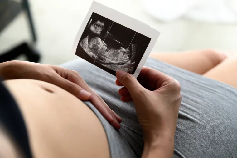 3. Prijevremeni porod:
Postoje dokazi da niske razine kolesterola mogu uzrokovati prijevremeni porod, prema studiji iz 2015. godine. &quot;Na temelju naših početnih otkrića, čini se da premalo kolesterola može biti jednako loše kao i previše kolesterola tijekom trudnoće, ali je prerano ekstrapolirati ove rezultate na opću populaciju&quot;, kaže dr. Max Muenke. &quot;Potrebno je više istraživanja kako bi se ponovio ovaj ishod i proširio na druge skupine. Za sada je najbolji savjet za trudnice da slijede upute svojih zdravstvenih djelatnika kada je riječ o prehrani i tjelovježbi.&quot;
